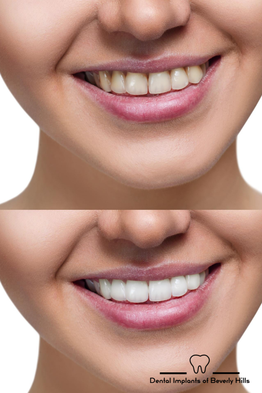woman-transformed-smile-before-and-after