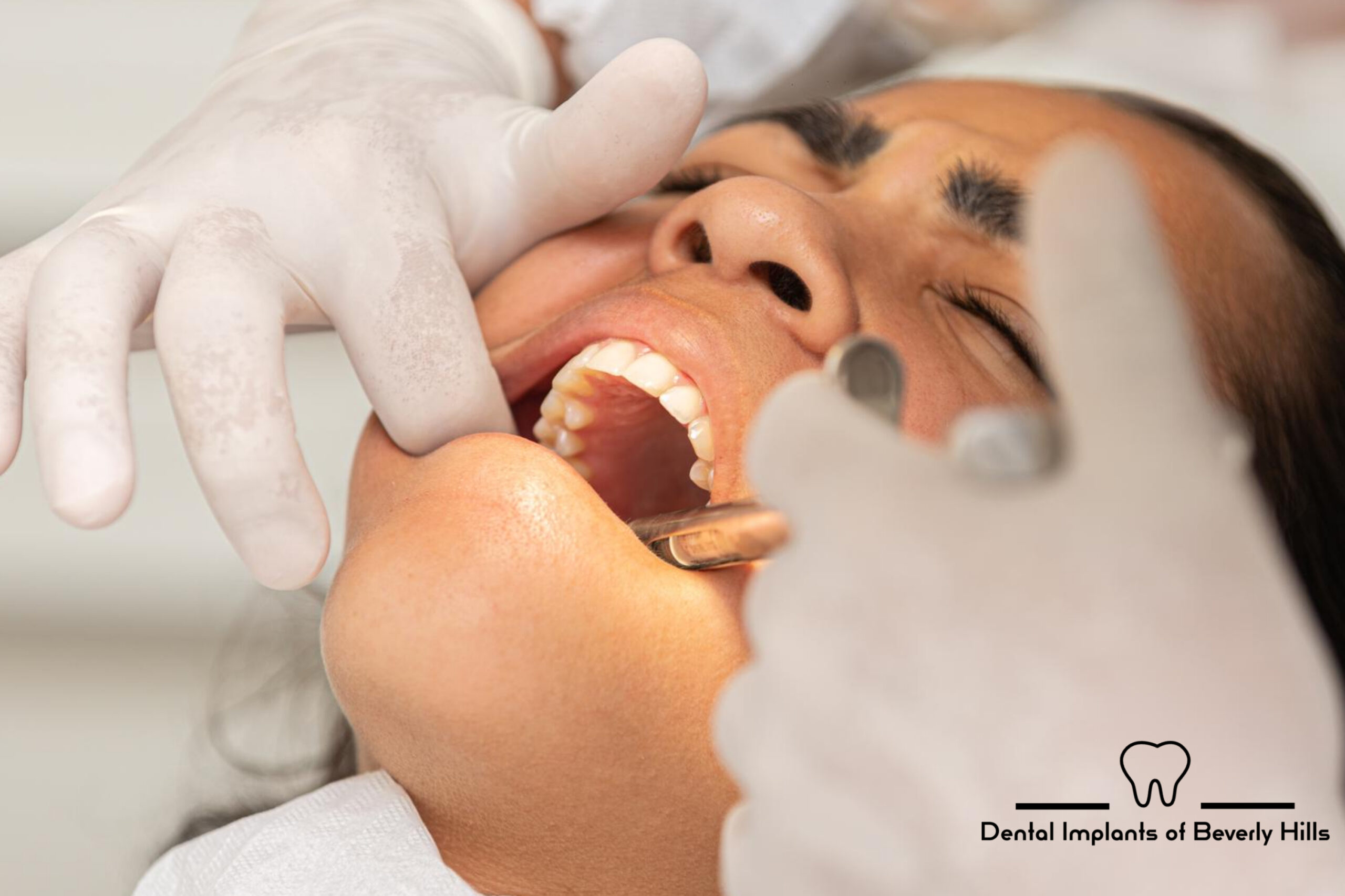 tooth-extraction-dentist-beverly-hills