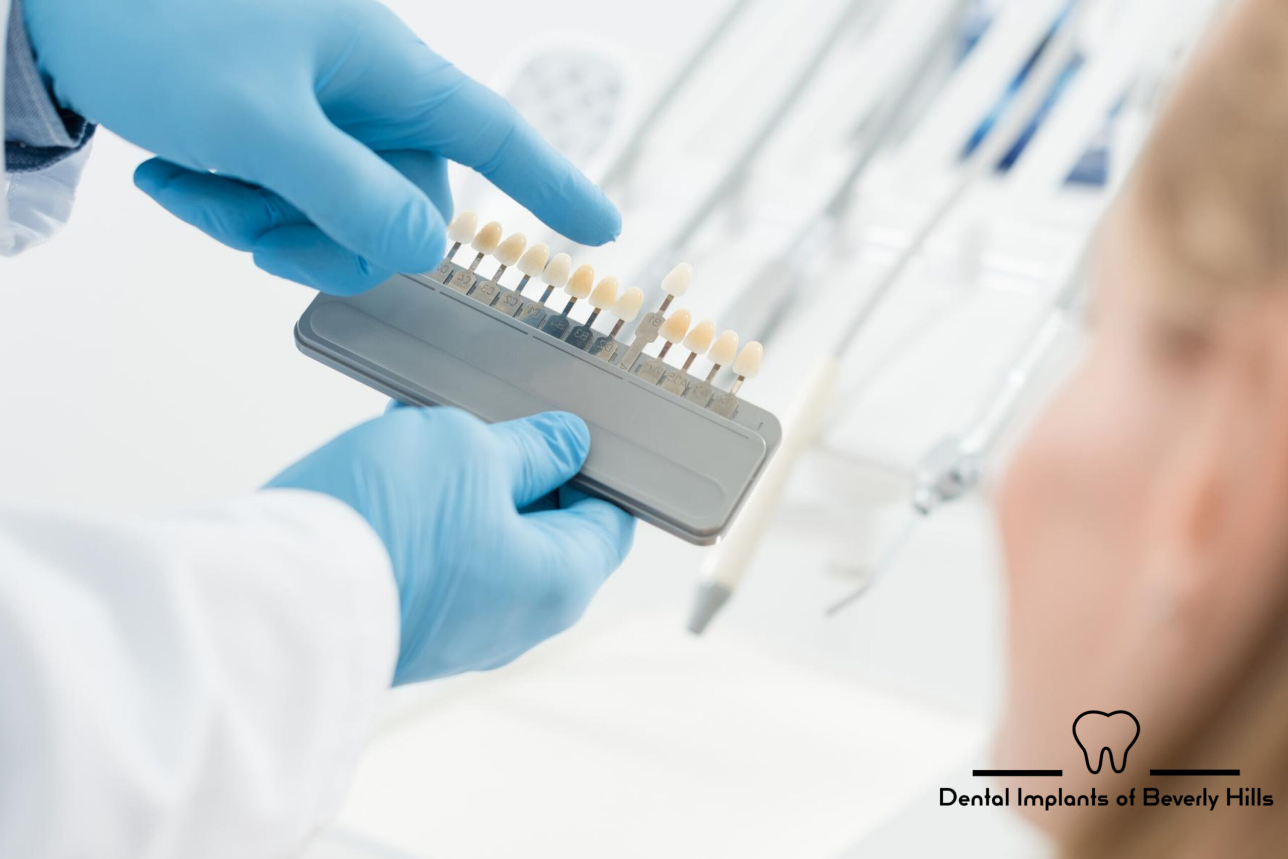 Dentist color matching options for dental implants